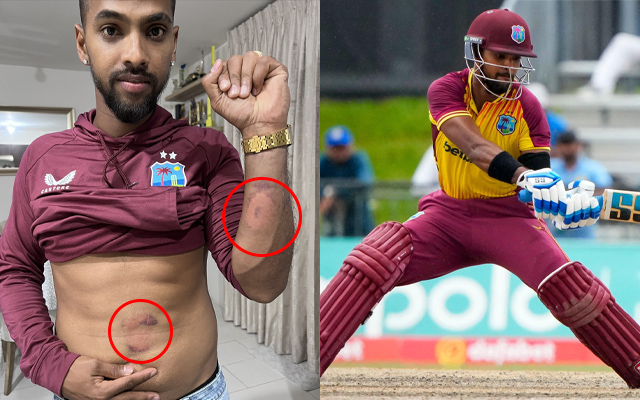 'The after effects' - Nicholas Pooran shows severe blows received by Arshdeep Singh's delivery and Brandon King's shot